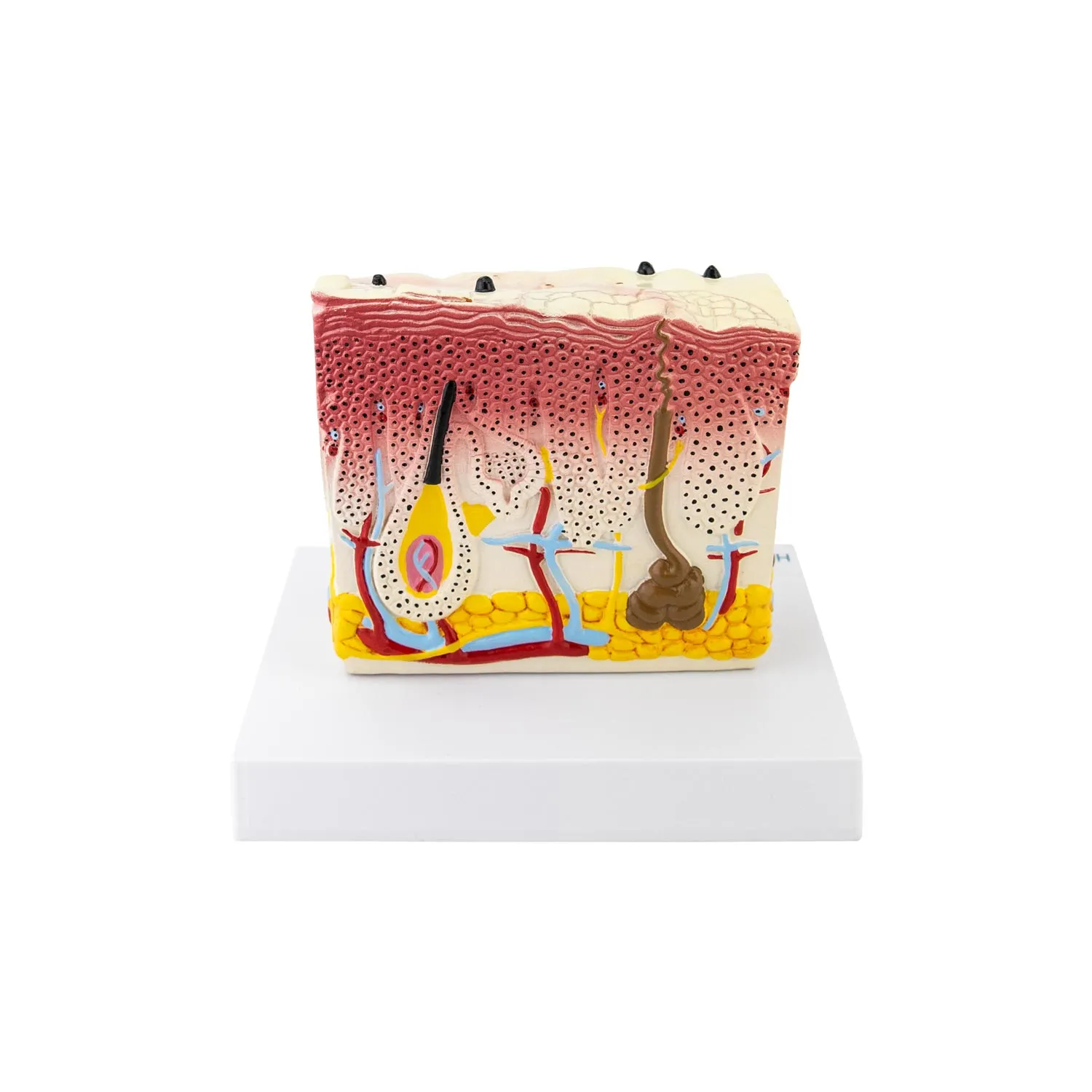 דגם עור פסוריאזיס - מודל אנטומי Psoriasis Skin Model – תמונה 3