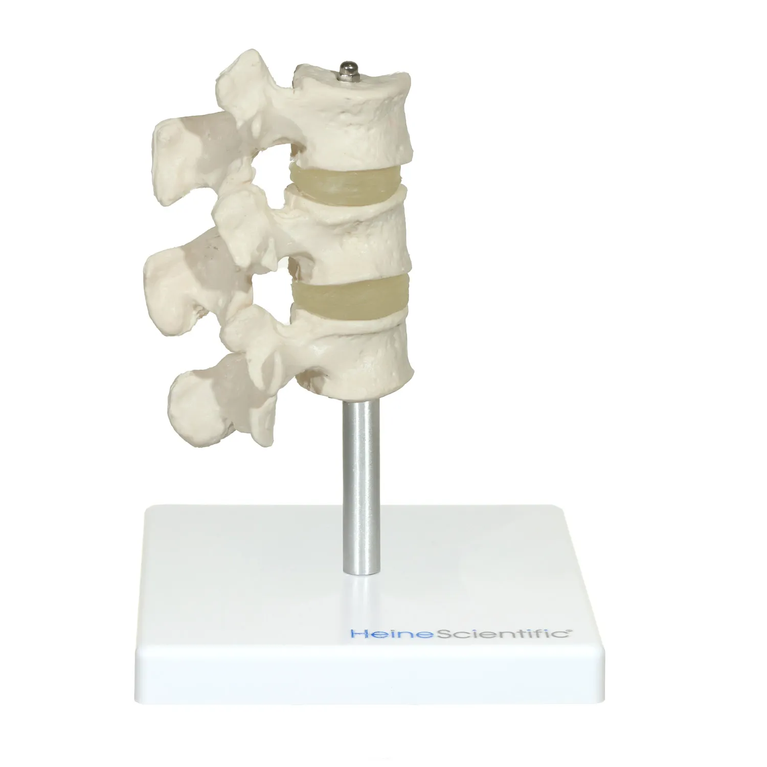 דגם אוסטאופורוזיס מקצועי - Osteoporosis Model להדגמת חוליות – תמונה 4