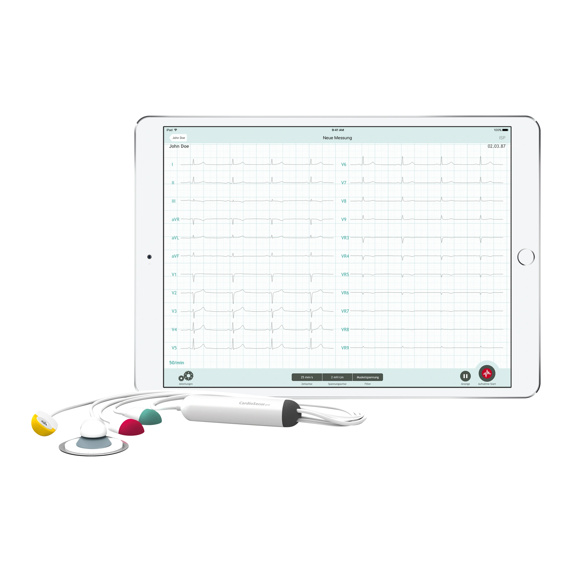 מכשיר אק״ג 12 ערוצים נייד CardioSecur Pro EKG