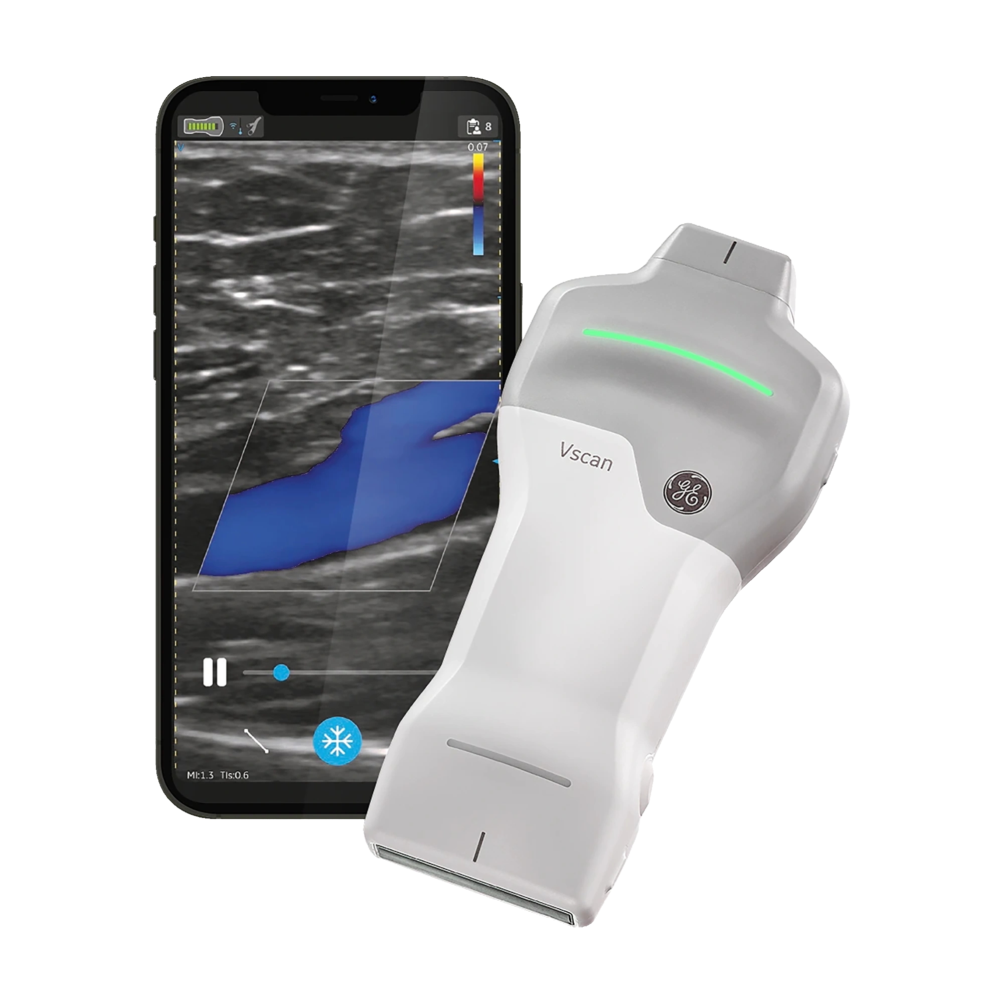 Vscan Air SL - מכשיר אולטרסאונד נייד אלחוטי Dual-Probe