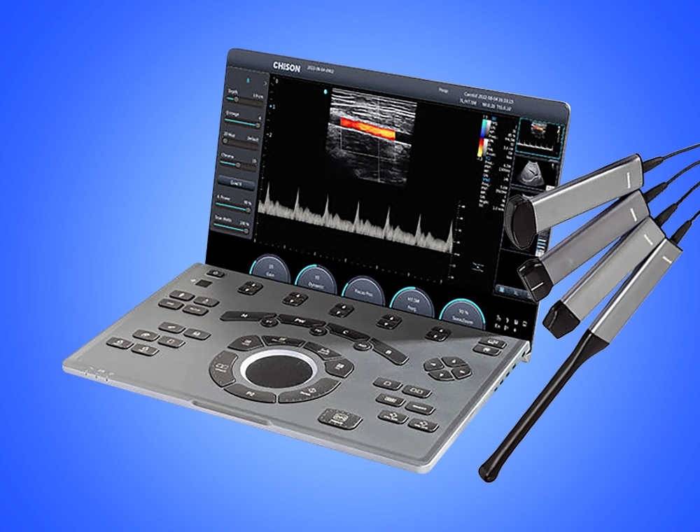 Chison SonoAir 70 - מכשיר אולטרסאונד נייד Color Doppler
