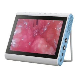 מערכת תצוגת אנדוסקופיה MIP1002 Besdata