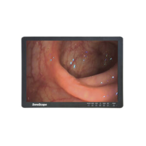 מסך LCD רפואי 24 אינץ' SonoScape עם ממשק DICOM