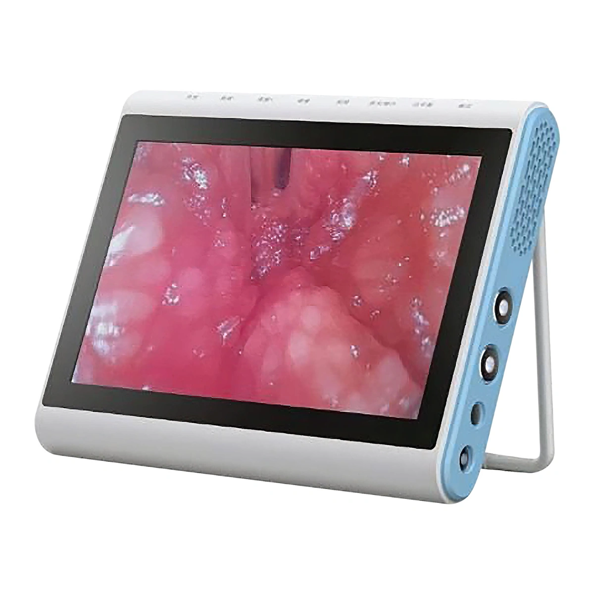 מערכת תצוגת אנדוסקופיה MIP1002 Besdata