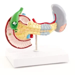 דגם אנטומי לבלב וטחול עם פתולוגיות - Pancreas & Spleen Model