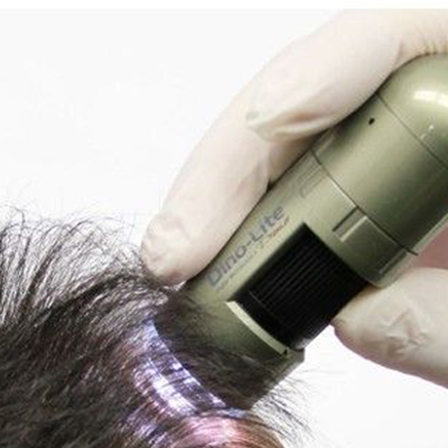 טריכוסקופ Dino-Lite TrichoScope Polarizer